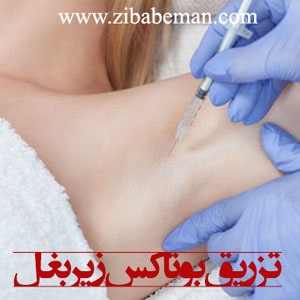 تزریق بوتاکس زیر بغل