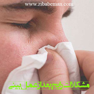 مشکلات رایج بعد از عمل بینی