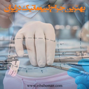 بهترین جراح لیپوماتیک در ایران