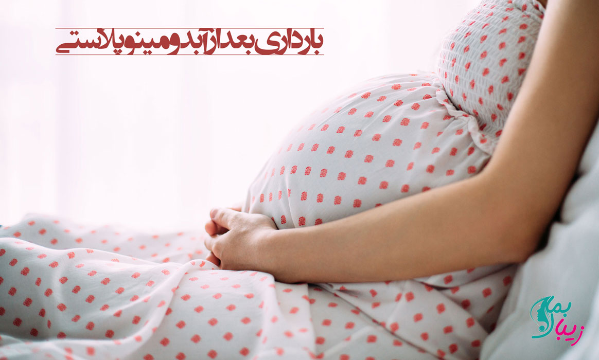 بارداری بعد از آبدومینوپلاستی