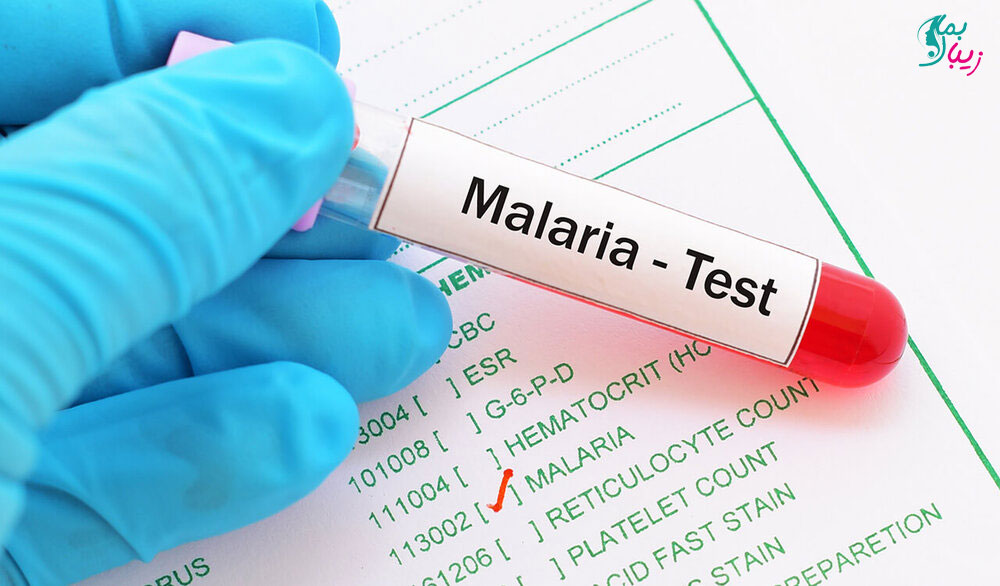 تشخیص و درمان مالاریا