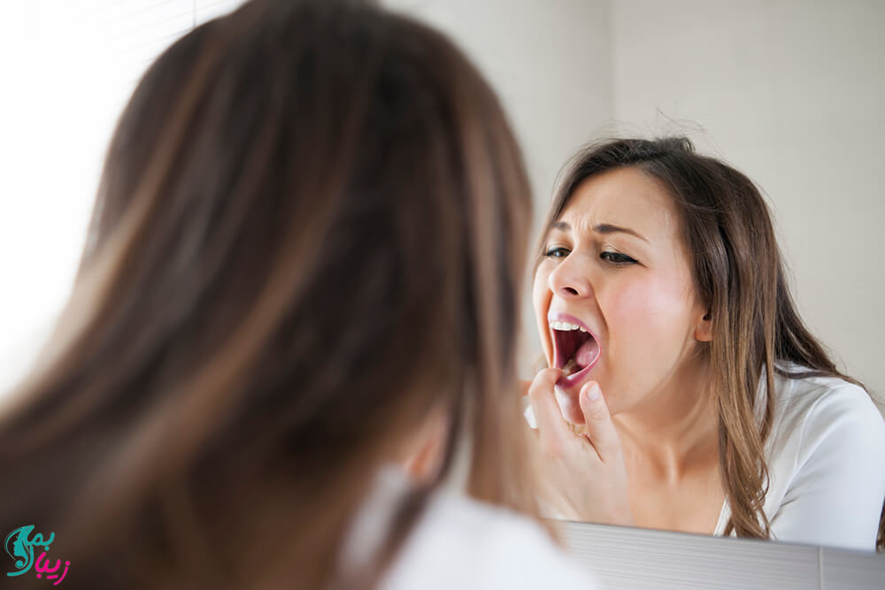 علت زخم دهان و گلو چیست
