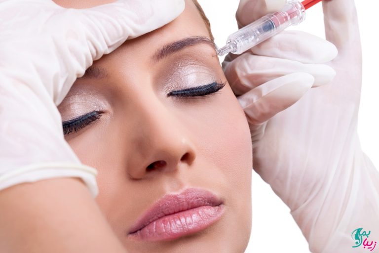 بوتاکس بهتر است یا لیفت با نخ؟ [راهنمای کامل] زیبا بمان