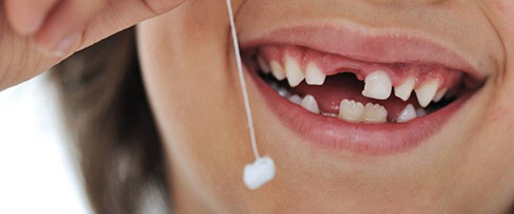 از دست دادن زودرس دندان در کودکان