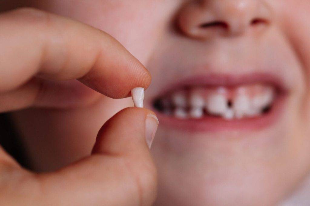 چگونه بفهمیم هنوز دندانهای شیری داریم