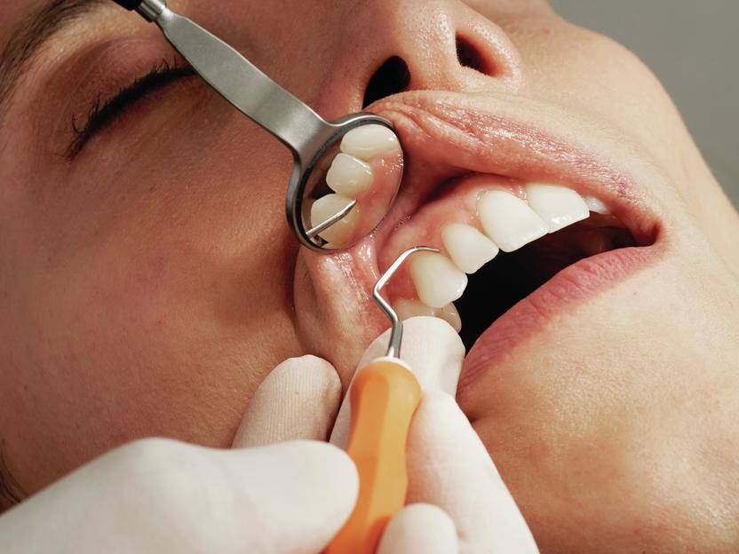 چگونه بفهمیم هنوز دندانهای شیری داریم