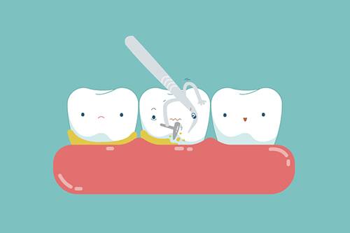 از بین بردن پلاک و جرم دندان