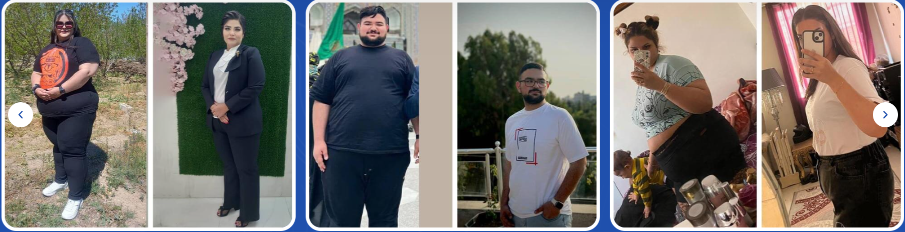 تصاویر قبل و بعد از عمل مینی بای پس افراد