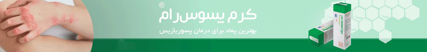 پسوریازیس صورت چیست