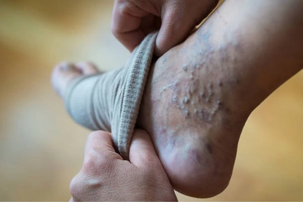 برند ایرانی پاک سمن از تولیدکنندگان معتبر و قدیمی تجهیزات پزشکی و حمایتی است.