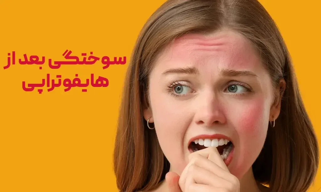 سوختگی بعد از هایفو چیست؟