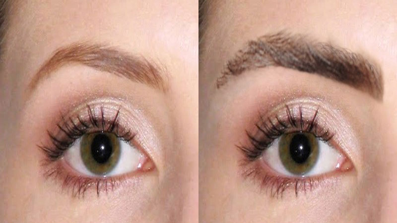 چرا افراد به کاشت ابرو نیاز پیدا می‌کنند؟