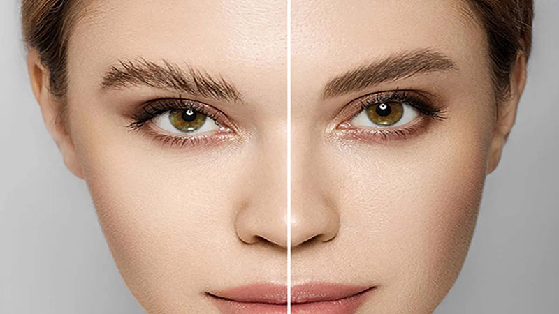 هزینه کاشت ابرو