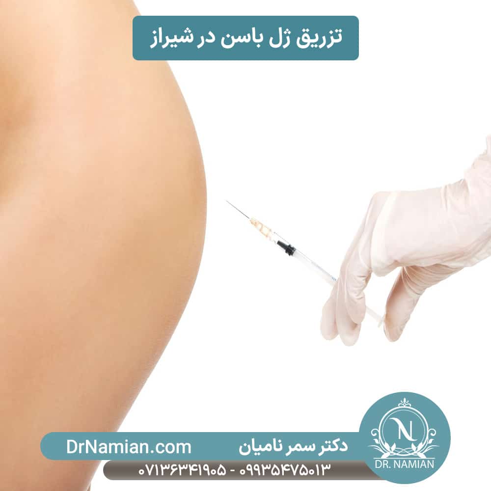 فیلر باسن در شیراز توسط دکتر سمر نامیان