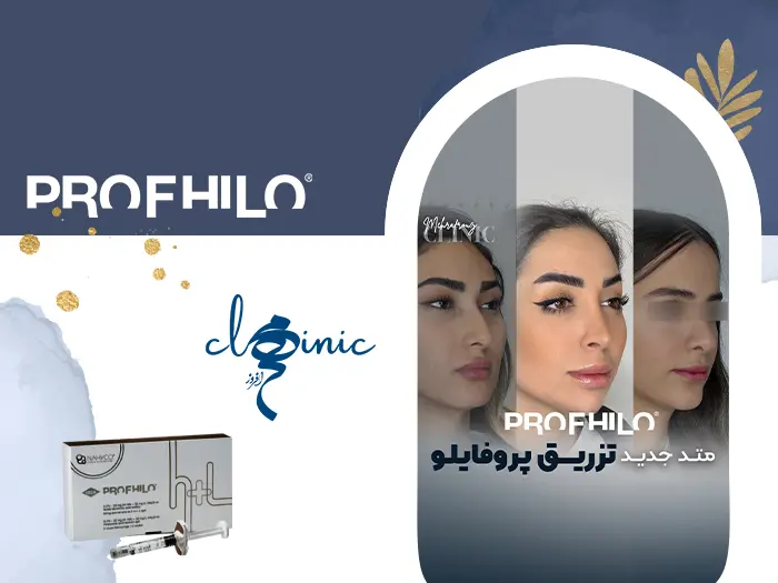 متد جدید تزریق پروفایلو