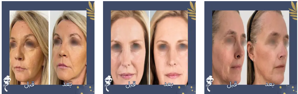 نمونه کار پروفایلو در کلینیک مهر افروز